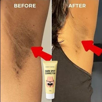 Underarm progress proof